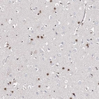 Immunohistochemical staining of human cerebral cortex shows strong nuclear positivity in glial cells.