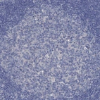 Immunohistochemical staining of human tonsil shows no positivity in germinal center cells as expected.