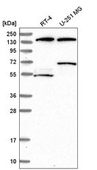 Western blot analysis in human cell line RT-4 and human cell line U-251 MG.
