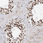 Immunohistochemical staining of human testis shows strong nuclear positivity in cells in seminiferous ducts.