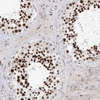 Immunohistochemical staining of human testis shows strong nuclear positivity in cells in seminiferous ducts.
