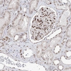 Immunohistochemical staining of human kidney shows strong nuclear positivity in cells in glomeruli.