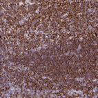 Immunohistochemical staining of human tonsil shows strong cytoplasmic positivity in non-germinal center cells.