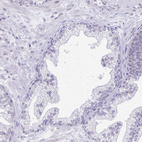 Immunohistochemical staining of human prostate shows no positivity in glandular cells as expected.