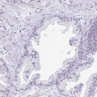 Immunohistochemical staining of human prostate shows no positivity in glandular cells as expected.