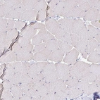 Immunohistochemical staining of human skeletal muscle shows no positivity in myocytes as expected.
