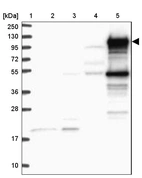 Lane 1: Marker [kDa] 250, 130, 95, 72, 55, 36, 28, 17, 10_br/_Lane 2: Human cell line RT-4_br/_Lane 3: Human cell line U-251 MG_br/_Lane 4: Human plasma_br/_Lane 5: Human Liver tissue