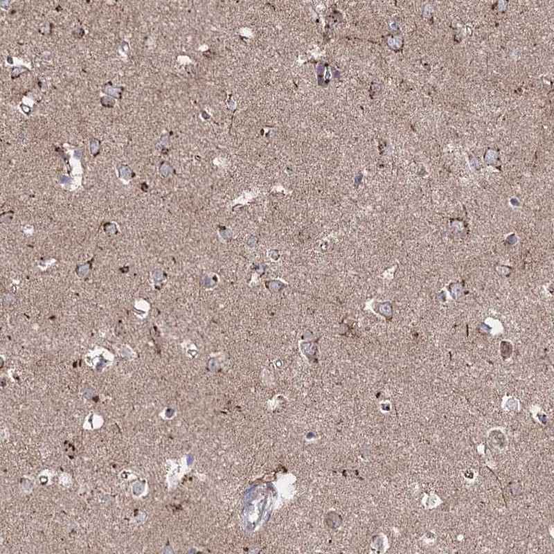 Anti-ARHGAP20 Antibody