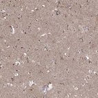 Anti-ARHGAP20 Antibody