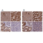 Immunohistochemical staining of human cerebral cortex, heart muscle, kidney and pancreas using Anti-CS antibody HPA038460 (A) shows similar protein distribution across tissues to independent antibody HPA038461 (B).