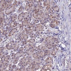 Anti-CS Antibody