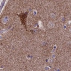 Anti-CS Antibody