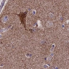 Immunohistochemical staining of human cerebral cortex using Anti-CS antibody HPA038460.