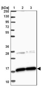 Lane 1: Marker [kDa] 250, 130, 95, 72, 55, 36, 28, 17, 10_br/_Lane 2: Human cell line RT-4_br/_Lane 3: Human cell line U-251MG sp