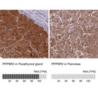 Anti-PPP6R3 Antibody