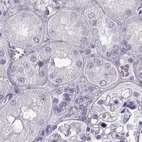 Immunohistochemical staining of human kidney using Anti-BFSP2 antibody HPA038464.