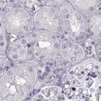 Immunohistochemical staining of human kidney using Anti-BFSP2 antibody HPA038464.