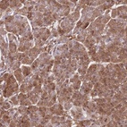 Immunohistochemical staining of human pancreas shows low expression as expected.
