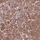 Immunohistochemical staining of human pancreas shows low expression as expected.