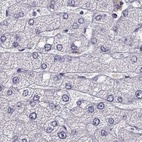 Immunohistochemical staining of human liver using Anti-BFSP2 antibody HPA038464.