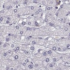 Anti-BFSP2 Antibody