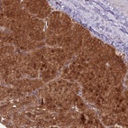 Anti-PPP6R3 Antibody