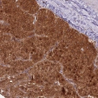 Immunohistochemical staining of human parathyroid gland shows high expression.