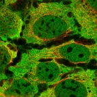 Immunofluorescent staining of human cell line CACO-2 shows localization to nucleoplasm, plasma membrane & cytosol.