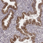 Immunohistochemical staining of human endometrium shows moderate to strong membranous and granular cytoplasmic positivity in glandular cells.