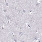 Immunohistochemical staining of human cerebral cortex using Anti-BFSP2 antibody HPA038464.
