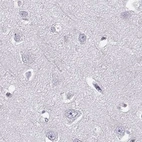 Immunohistochemical staining of human cerebral cortex using Anti-BFSP2 antibody HPA038464.