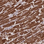 Immunohistochemical staining of human heart muscle shows moderate to strong cytoplasmic positivity in cardiomyocytes.