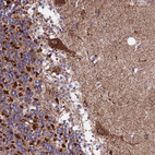 Anti-CS Antibody