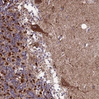 Immunohistochemical staining of human cerebellum shows moderate to strong cytoplasmic positivity in Purkinje cells.