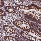 Immunohistochemical staining of human colon shows strong cytoplasmic positivity in glandular cells.