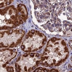 Immunohistochemical staining of human kidney using Anti-CS antibody HPA038461.