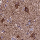 Anti-CS Antibody