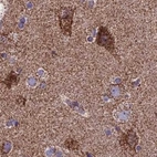 Immunohistochemical staining of human cerebral cortex using Anti-CS antibody HPA038461.