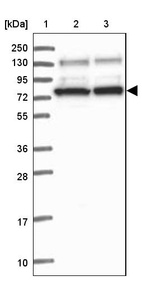 Lane 1: Marker [kDa] 250, 130, 95, 72, 55, 36, 28, 17, 10_br/_Lane 2: Human cell line RT-4_br/_Lane 3: Human cell line U-251MG sp