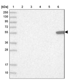 Lane 1: Marker [kDa] 250, 130, 95, 72, 55, 36, 28, 17, 10_br/_Lane 2: Human cell line RT-4_br/_Lane 3: Human cell line U-251MG sp_br/_Lane 4: Human plasma (IgG/HSA depleted)_br/_Lane 5: Human liver tissue_br/_Lane 6: Human tonsil tissue