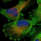 Immunofluorescent staining of human cell line U-251 MG shows localization to plasma membrane & cytosol.