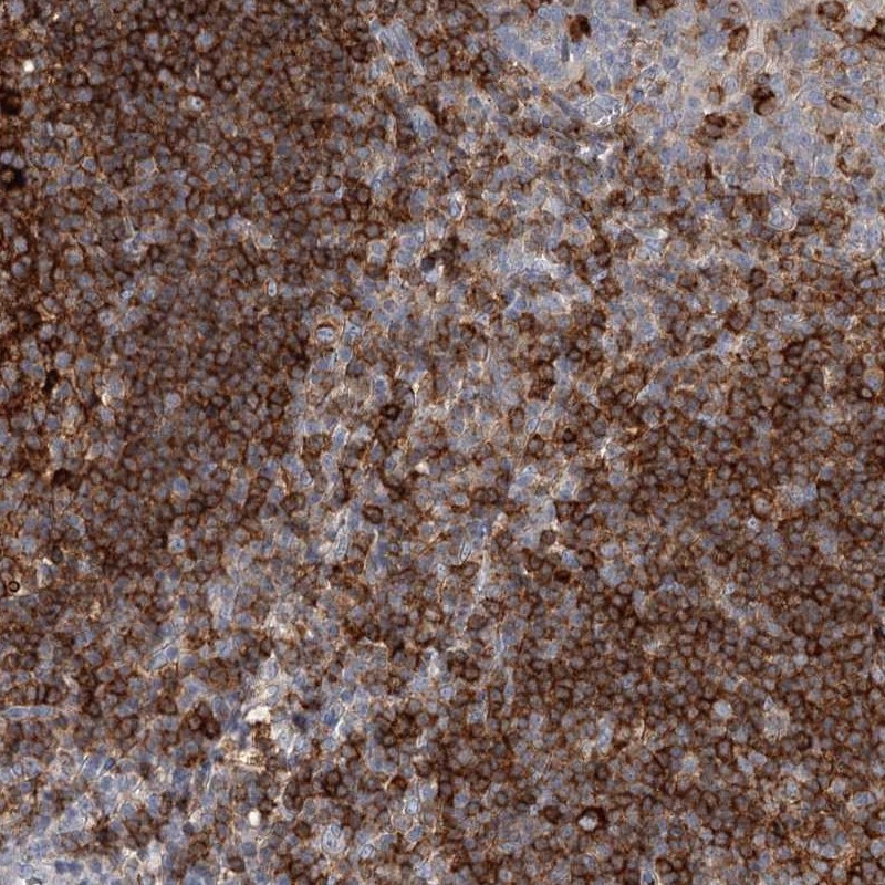 Anti-SNX22 Antibody