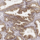 Immunohistochemical staining of human prostate shows moderate to strong membranous and granular cytoplasmic positivity in glandular cells.