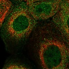 Immunofluorescent staining of human cell line A-431 shows localization to nucleoplasm & vesicles.