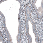 Immunohistochemical staining of human endometrium shows moderate granular cytoplasmic positivity.