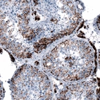 Immunohistochemical staining of human testis shows moderate to strong granular cytoplasmic positivity.
