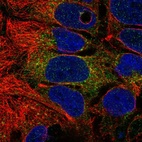 Immunofluorescent staining of human cell line CACO-2 shows localization to cytosol.