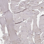 Immunohistochemical staining of human skeletal muscle shows no positivity in striated muscle fibers as expected.