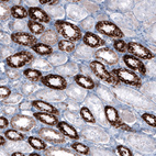 Immunohistochemical staining of human kidney shows granular cytoplasmic positivity in cells in tubules.
