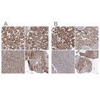 Immunohistochemical staining of human heart muscle, kidney, pancreas and skeletal muscle using Anti-PDHX antibody HPA038484 (A) shows similar protein distribution across tissues to independent antibody HPA038485 (B).
